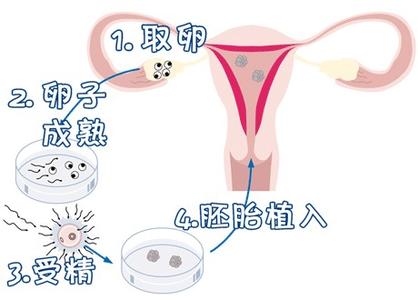 严重少弱精案例